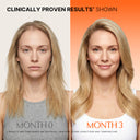 [Hair Regrowth Trio] GROWTURN Scalp Revitalize Routine for Hair Growth