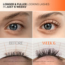 [20% OFF — Amazon #1 New Release🎉] Growturn 24/7 Dual Eyelash Growth Serum