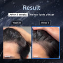 [20% OFF — Limited  Back-to-School Deal Deal🔥] Growturn Hair Growth Prime Serum for MAN