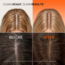 [NEW] lilyeve GROWTURN Scalp Cleansing Pads for Oily Hair, No-Rinse