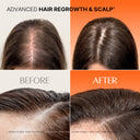 [New Launch] Hair Growth Activator —  Growturn Exosome Spicule Ampoule 3000