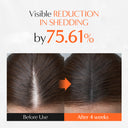 [Prime Day Big Deal | Oct 7 - 8 Only] Growturn Hair Serum With Built in Brush 3.38fl oz