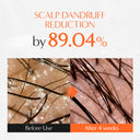 [Prime Day Big Deal | Oct 7 - 8 Only] Growturn Hair Serum With Built in Brush 3.38fl oz