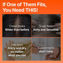 Growturn Hair Brush Serum Designed for Aging Scalps l Clinically Proven for Visibly Fuller Hair & Healthy Scalp