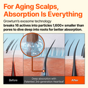Growturn Hair Brush Serum Designed for Aging Scalps l Clinically Proven for Visibly Fuller Hair & Healthy Scalp