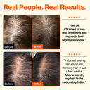 Growturn Hair Brush Serum Designed for Aging Scalps l Clinically Proven for Visibly Fuller Hair & Healthy Scalp