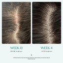 [20% Off - Launch Deal] Scalpturn Cica PDRN Brush Serum