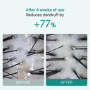 [20% Off - Launch Deal] Scalpturn Cica PDRN Brush Serum