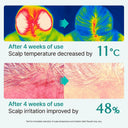 [20% Off - Launch Deal] Scalpturn Cica PDRN Brush Serum